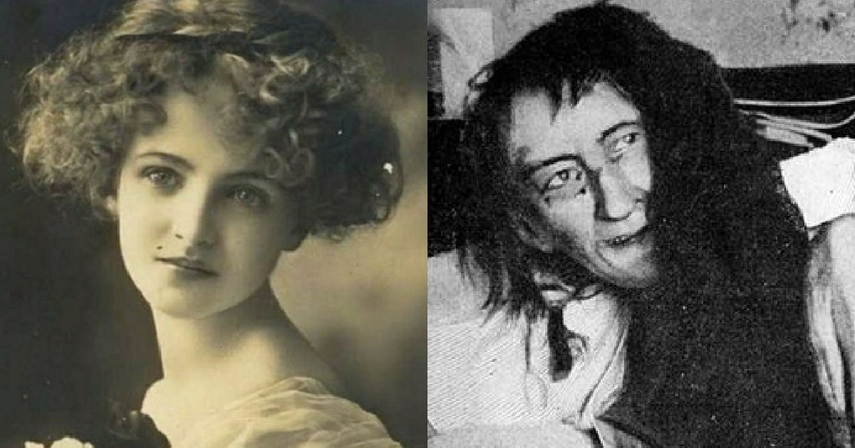 Blanche Monnier: The woman who was locked in an attic.