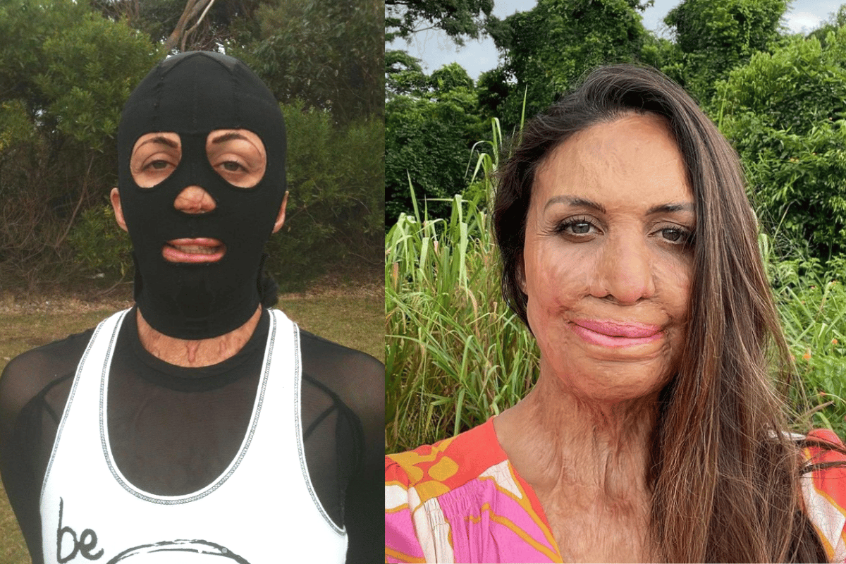 Turia Pitt Shares Her Story On Celebrity Apprentice Australia