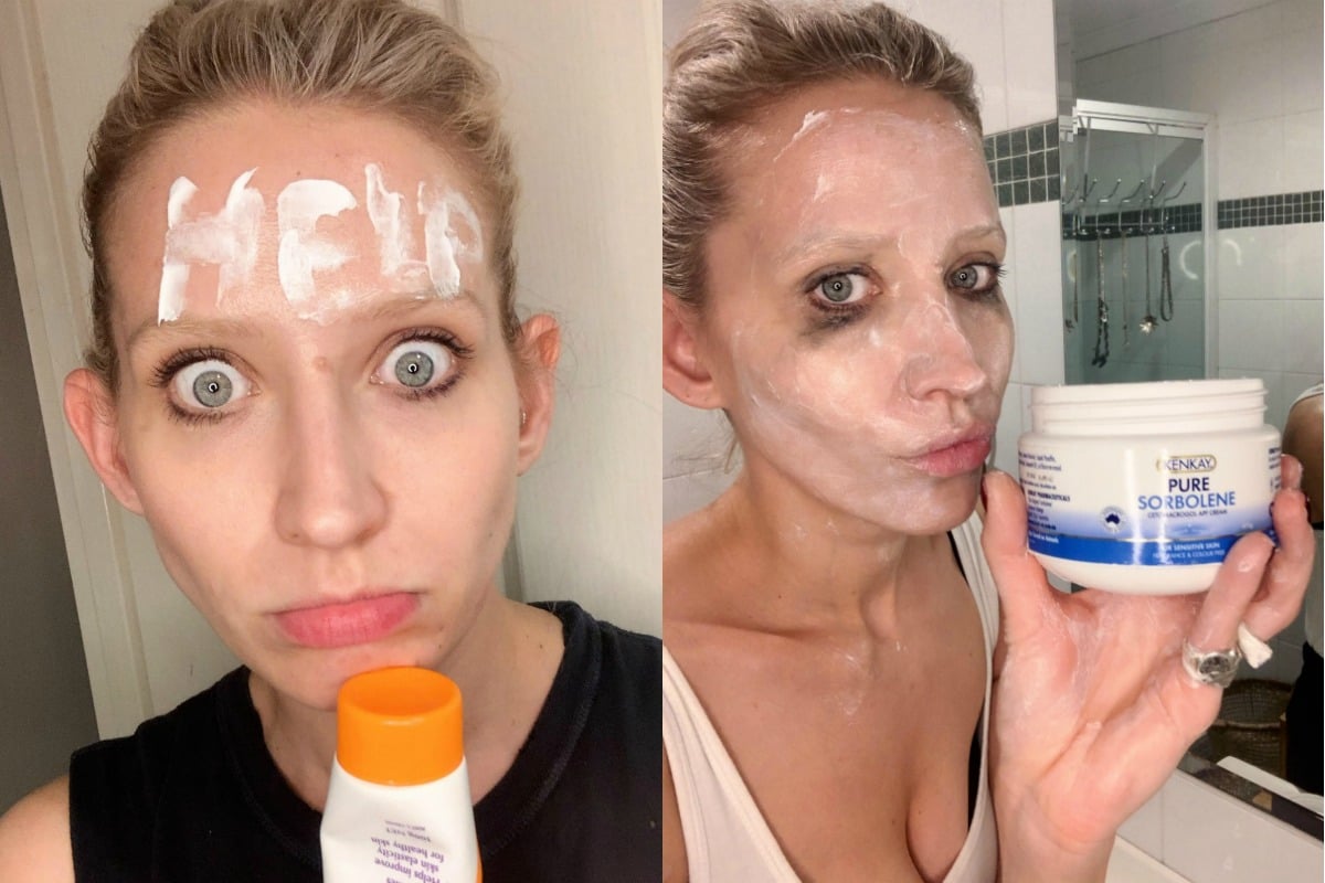Skincare chemical burn: The products that healed my face. 