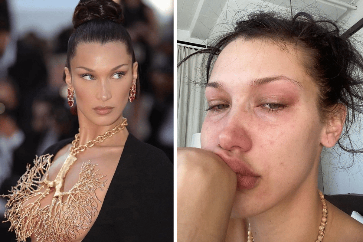 Bella Hadid Shares a Tear-Filled Message About Her Daily Struggle