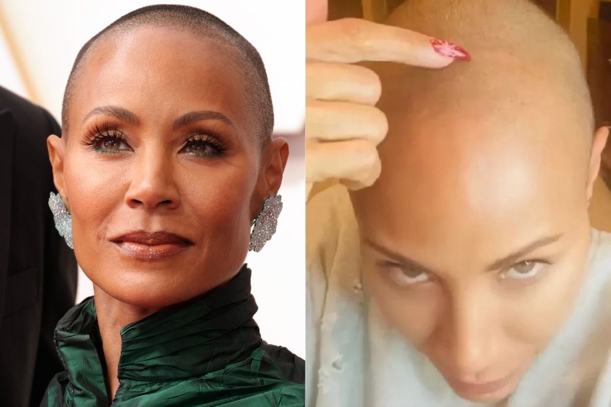 Jada Pinkett Smith shares struggle with alopecia.