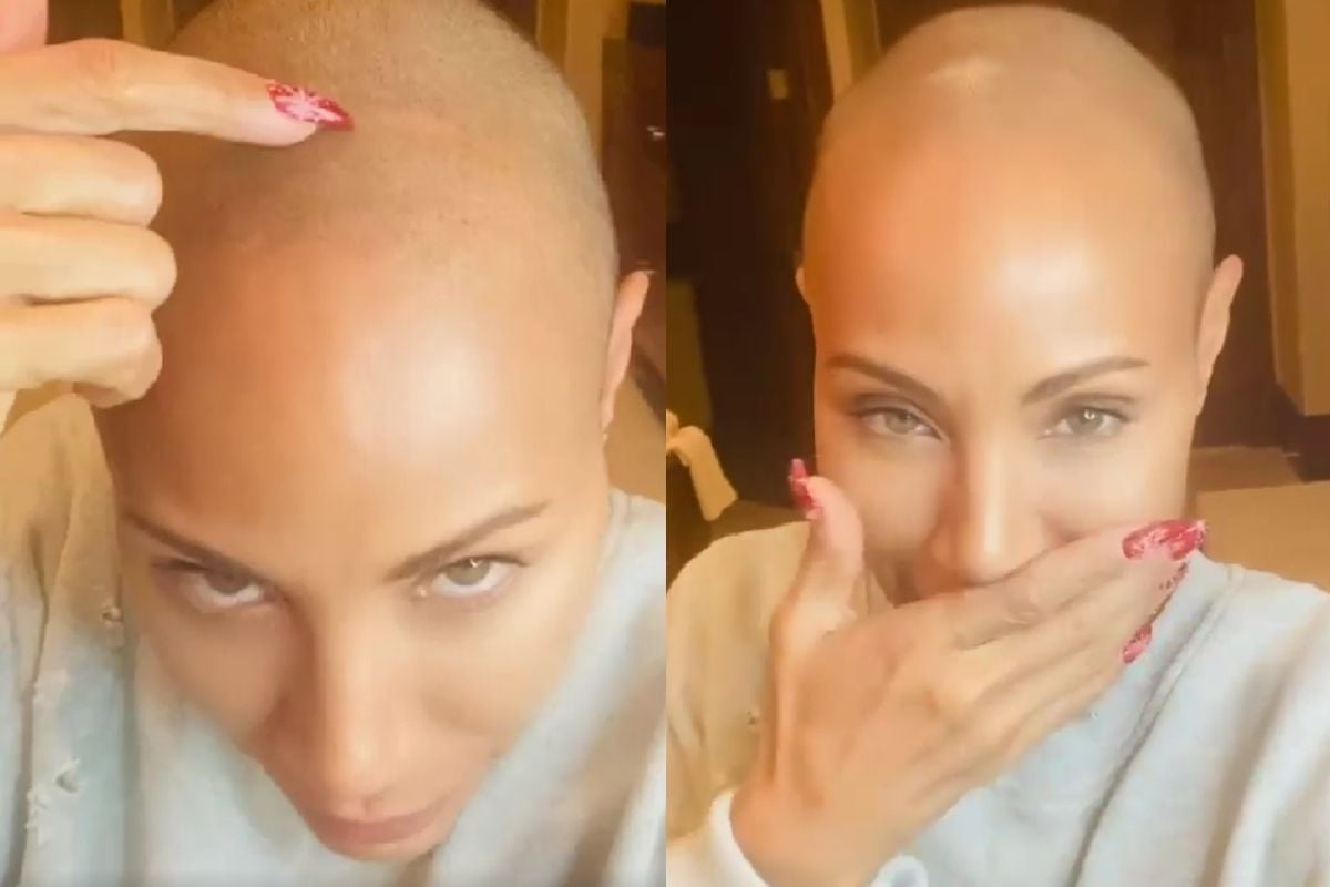 Jada Pinkett Smith Shares Struggle With Alopecia 