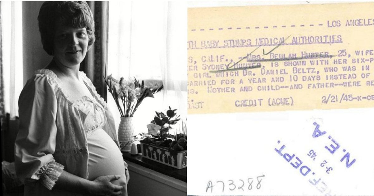 longest-human-pregnancy-beulah-hunter-1945