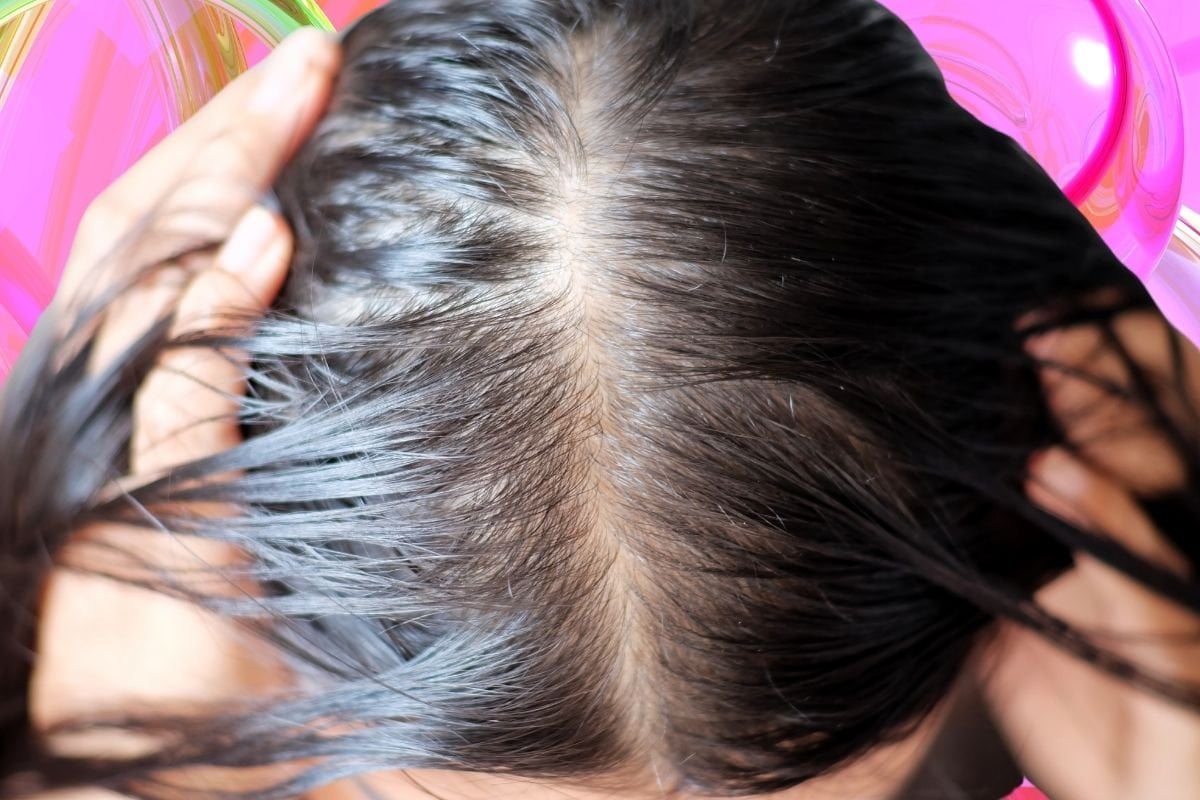 The best hair loss treatments that actually work.