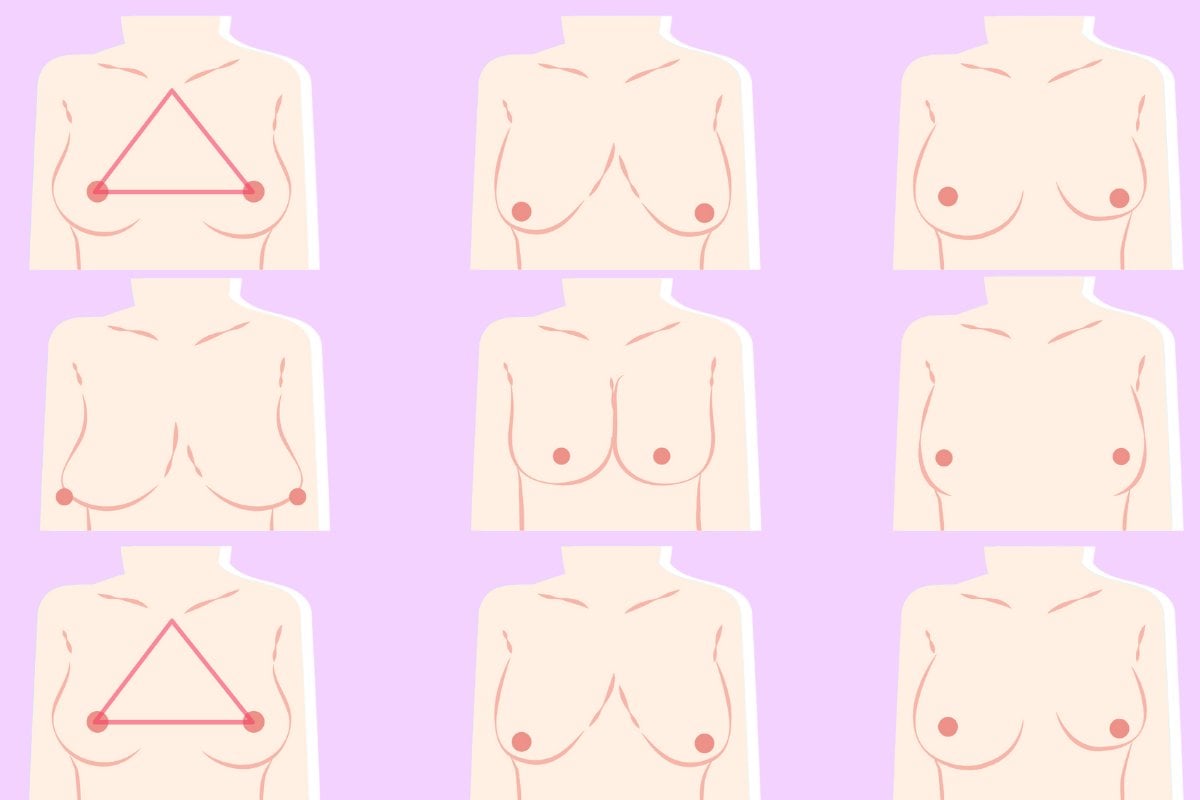 Breast implant decision: How to decide to get a boob job.