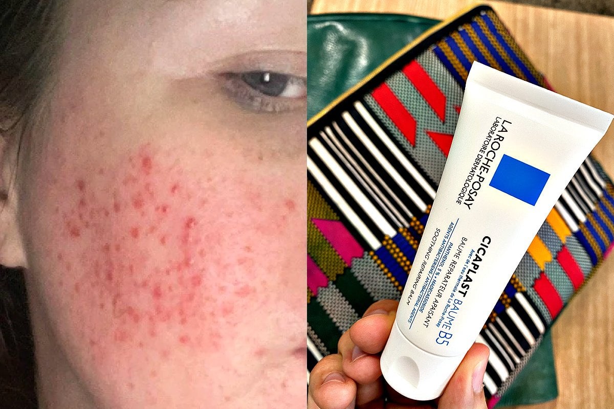 La Roche Posay Cicaplast review: fix red