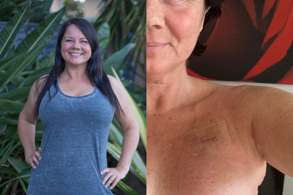 How double mastectomy affects body image.