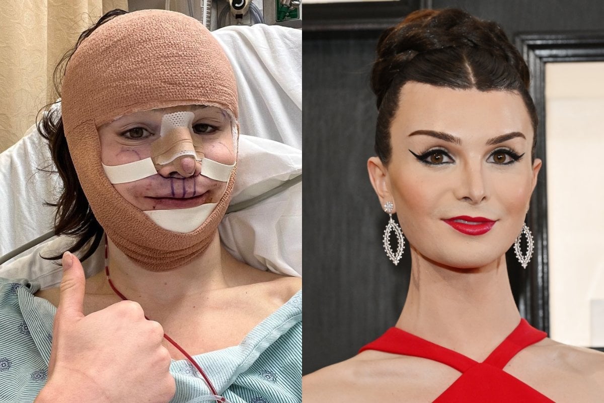 TikToker Dylan Mulvaney shares face reveal after surgery