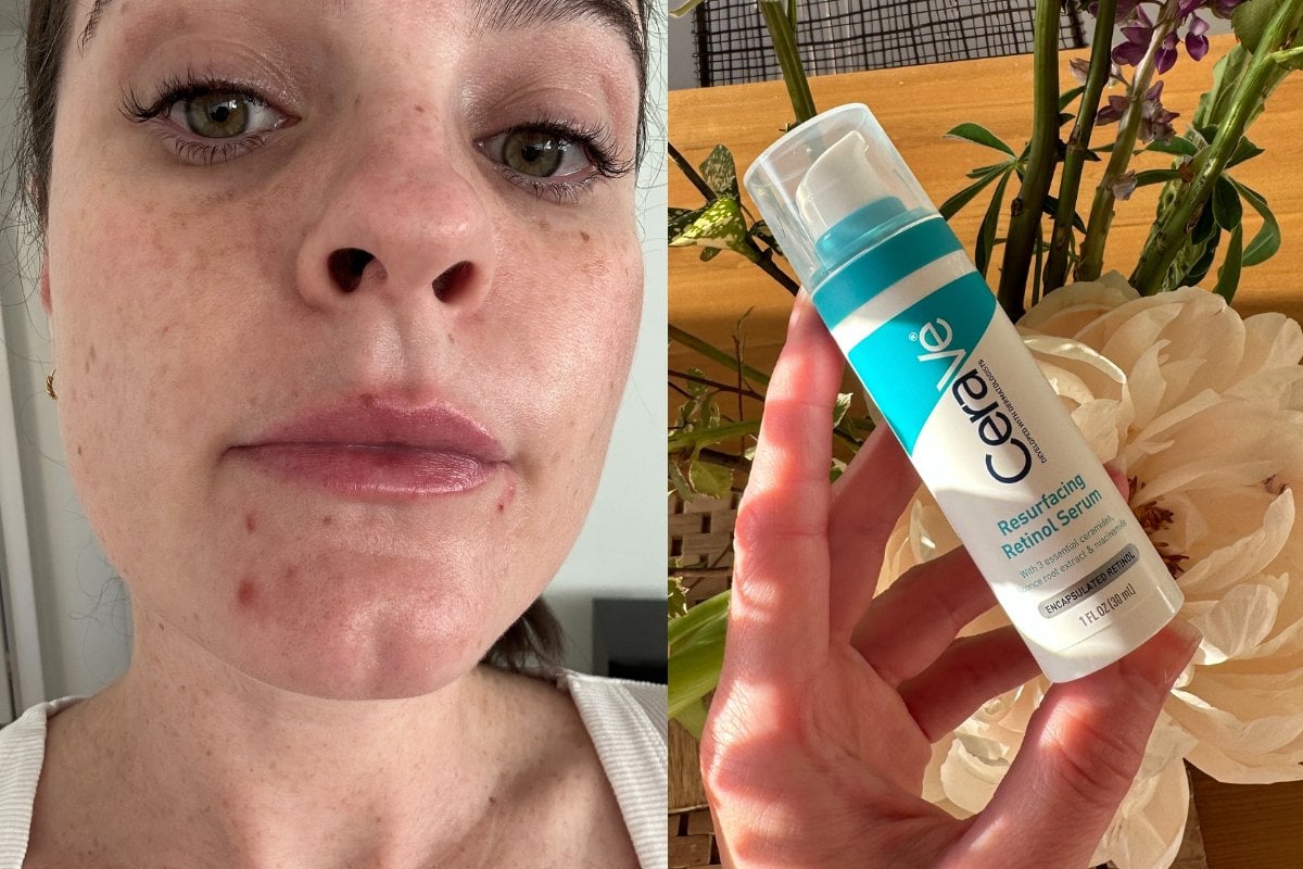 NEW CeraVe ACNE CONTROL GEL & CLEANSER review