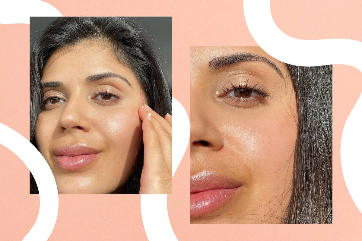 hydroquinone cream before and after