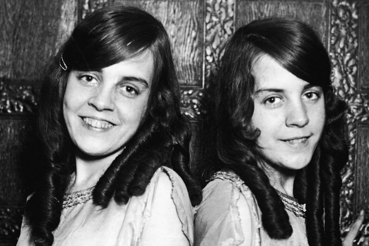 Daisy And Violet Hilton Were Born Conjoined Twins