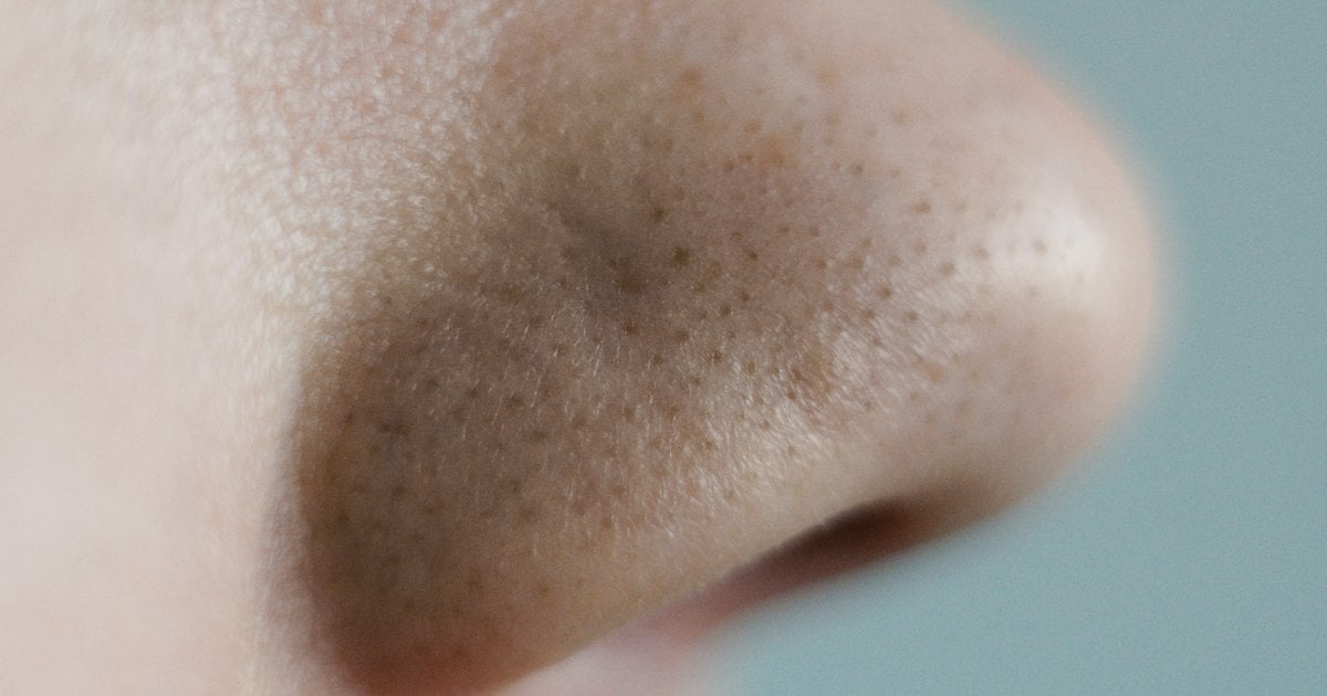 how to remove blackheads from nose at home instantly