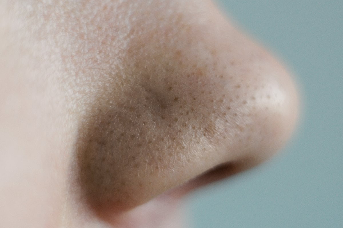 How to get rid of blackheads on your nose.