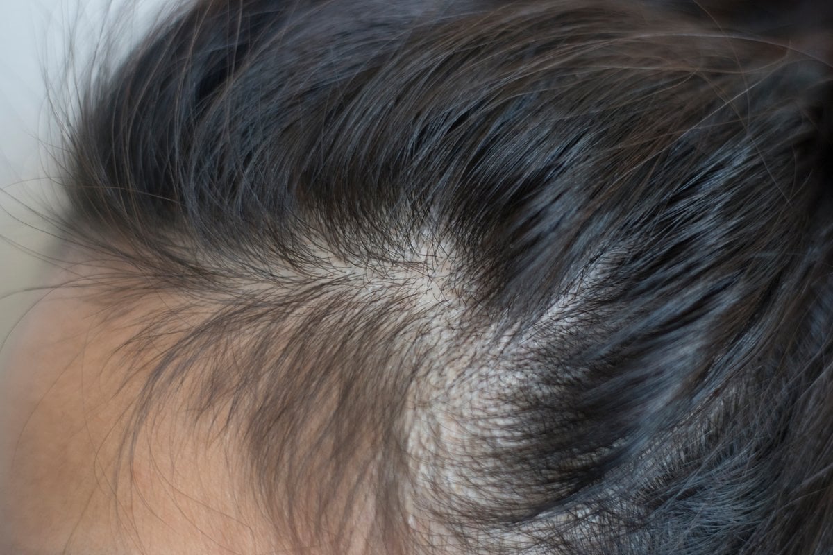 Baby Hairs or Breakage: How to Tell Which You Have