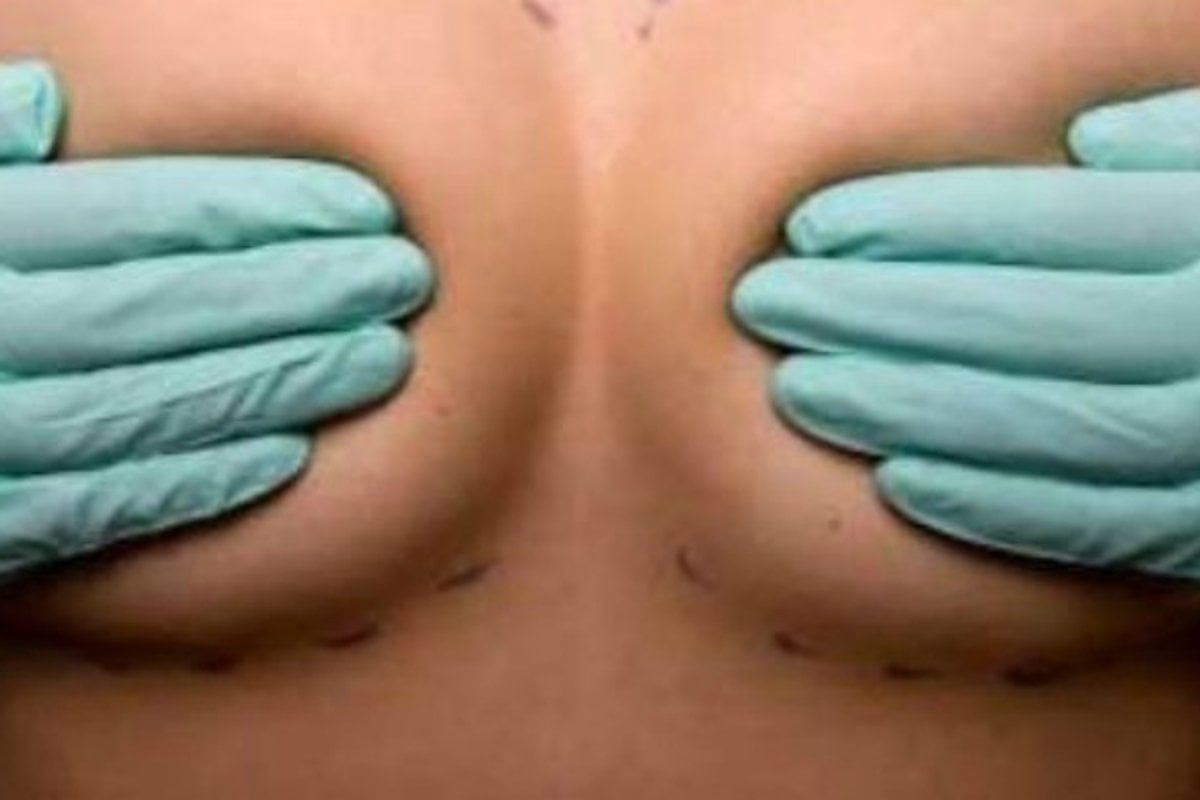 The Myth of The Perfect Breast, Part 2: From The No-Bra to The T