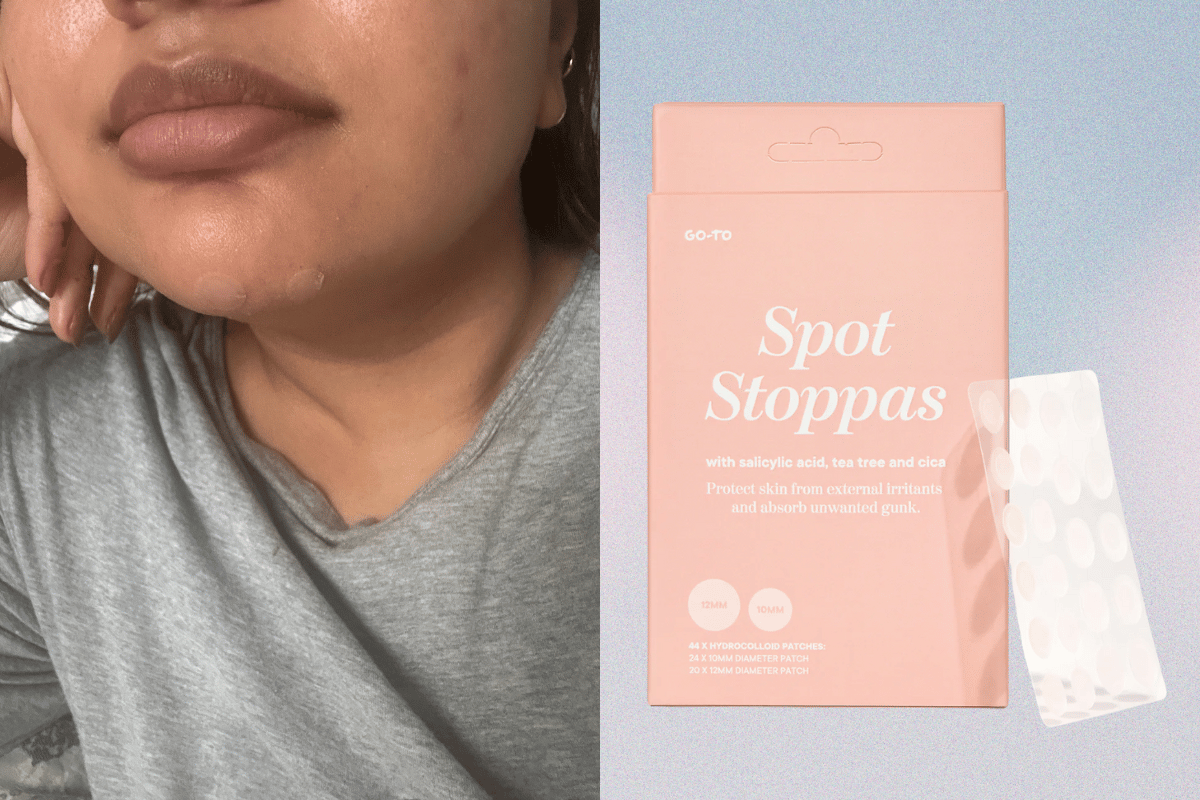 Go To pimple patches.