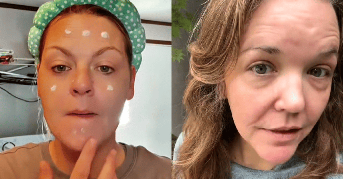 Why women are putting vaginal cream on their face.