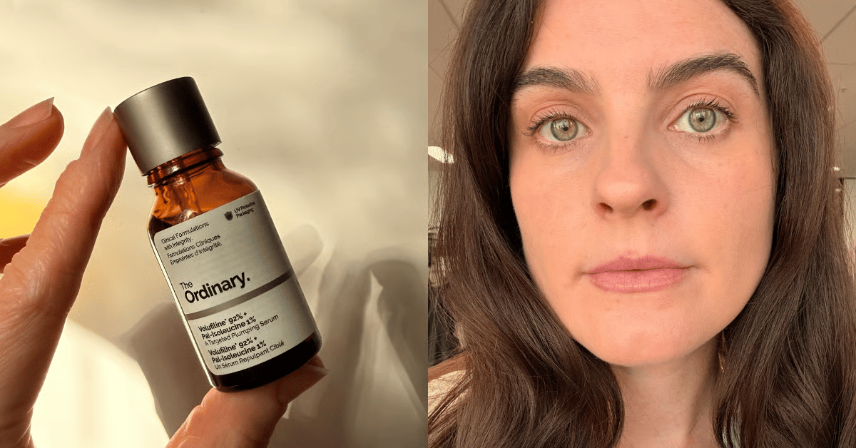 'I put this serum on my string-bean lips for 14 days to see if it would make a difference.'