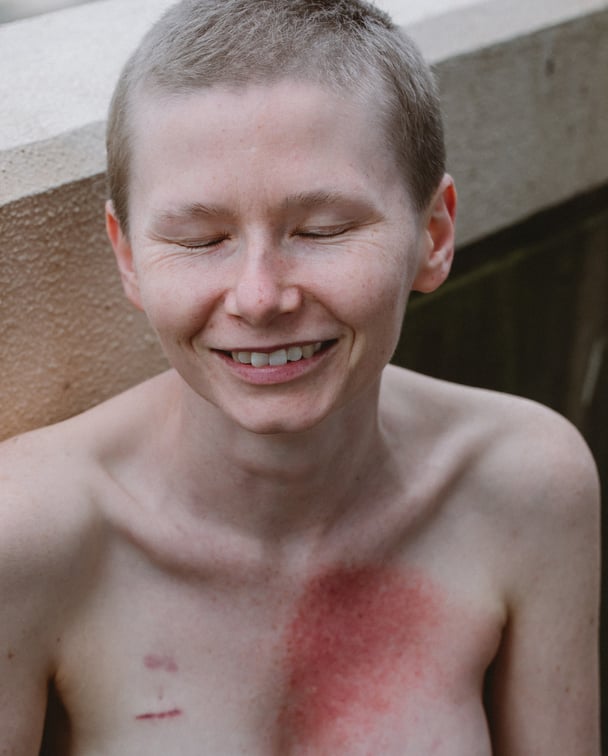 rhiannon-breast-cancer-unsaid-project