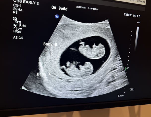 Nikolina-twins-ultrasound.