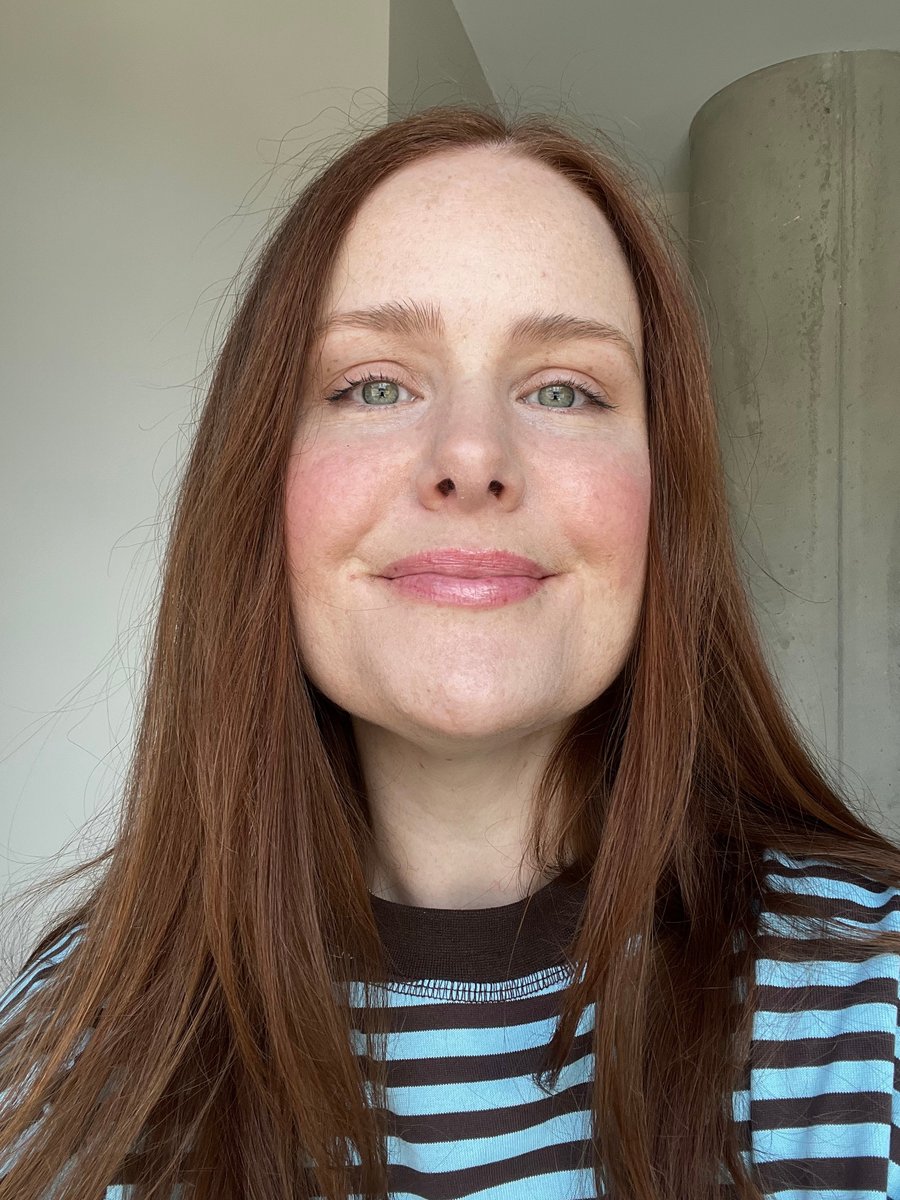 amy mecca max foundation before and after 