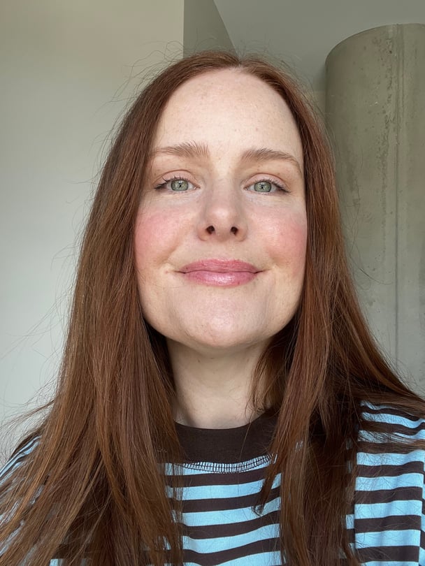 amy mecca max foundation before and after