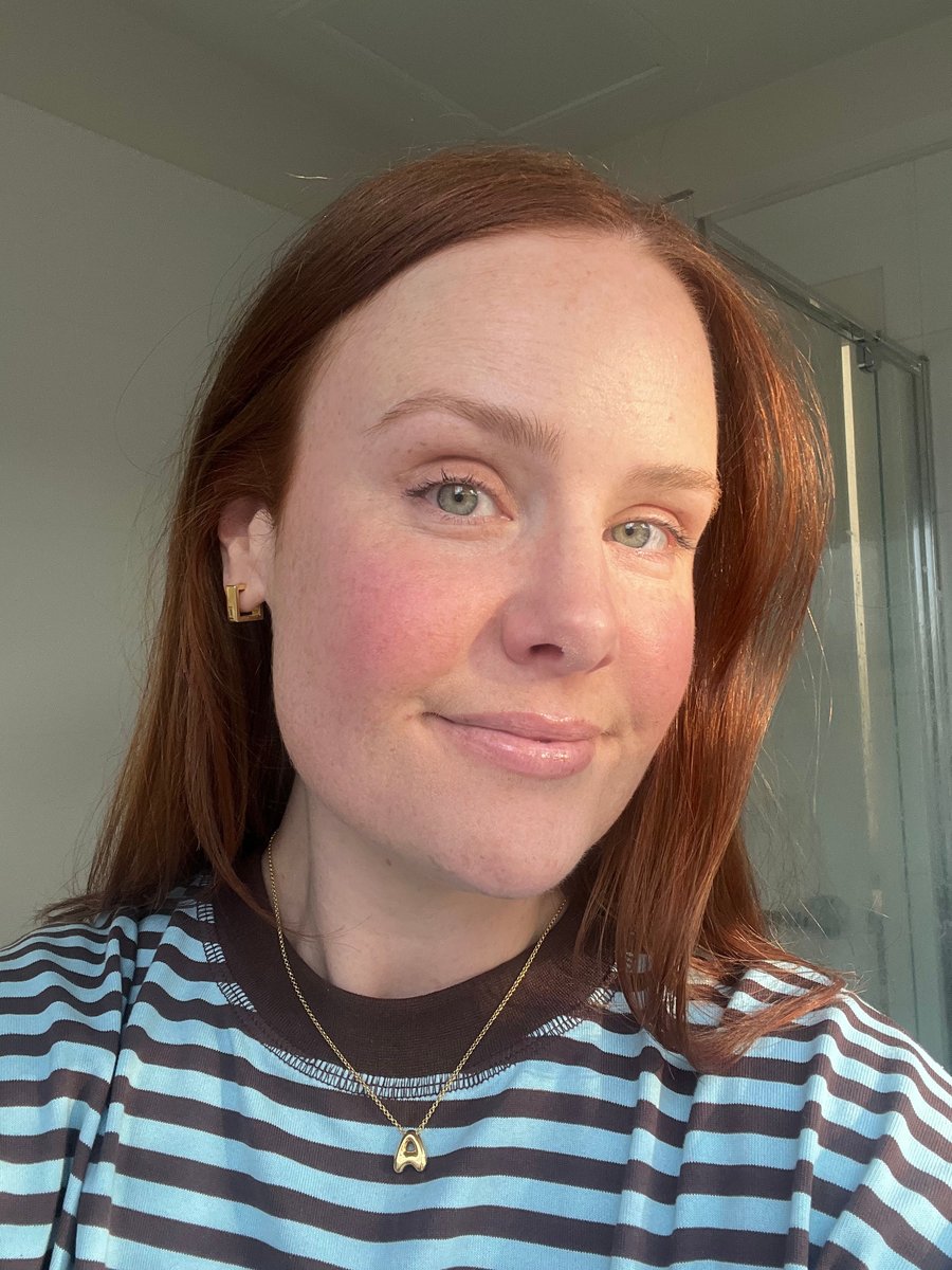 amy mecca max foundation before and after