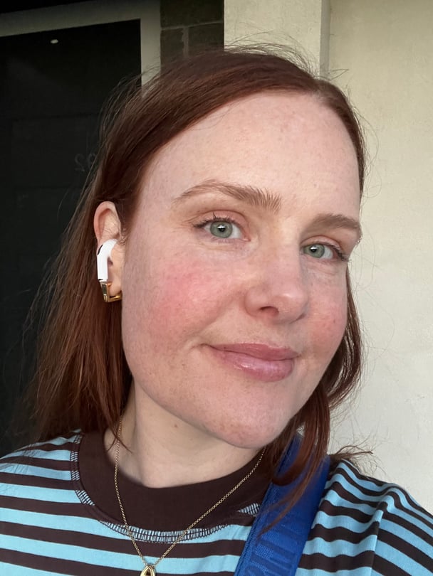 amy mecca max foundation before and after