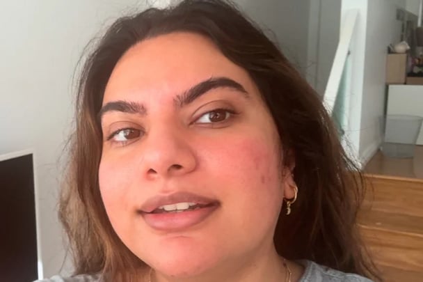 My face after using Prime Skin's Jelly Plump.