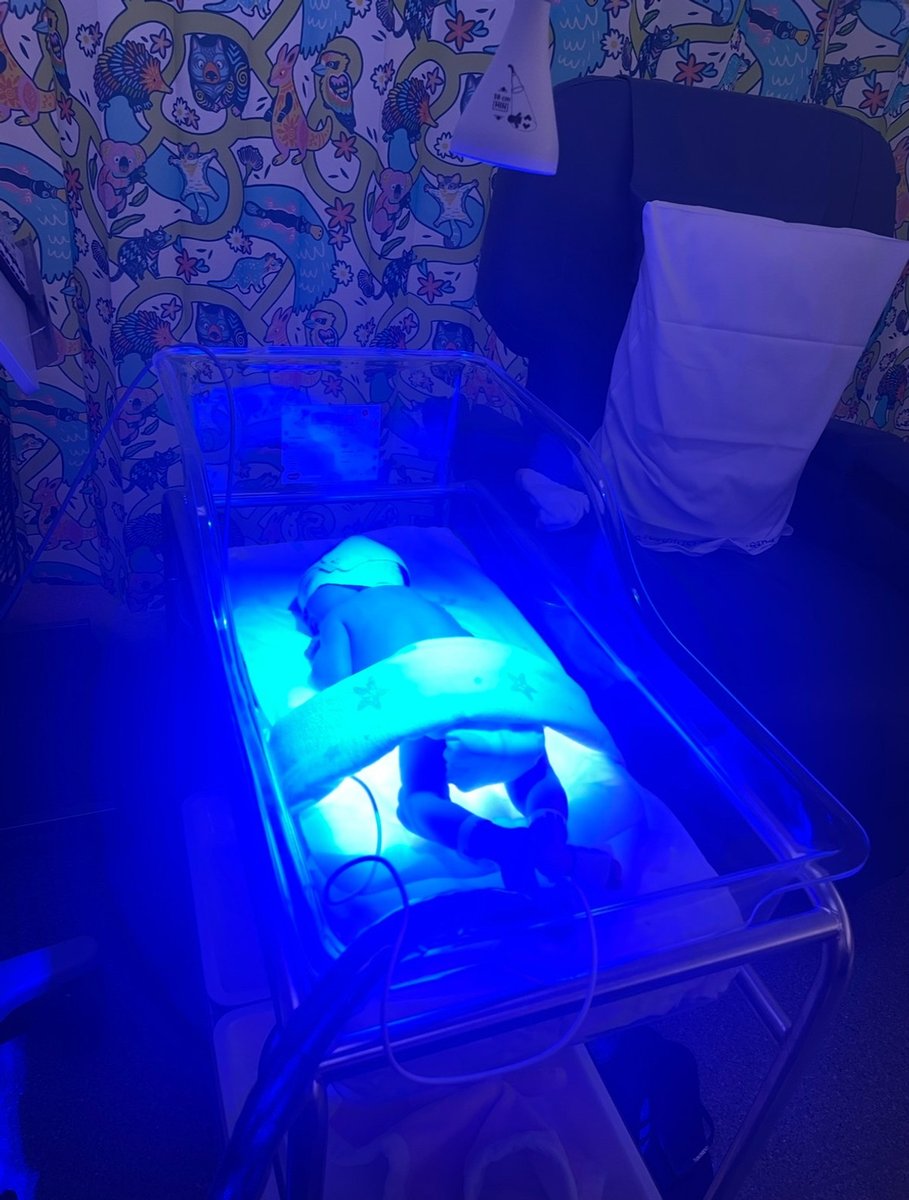 A baby is basking in the blue light of an incubator.