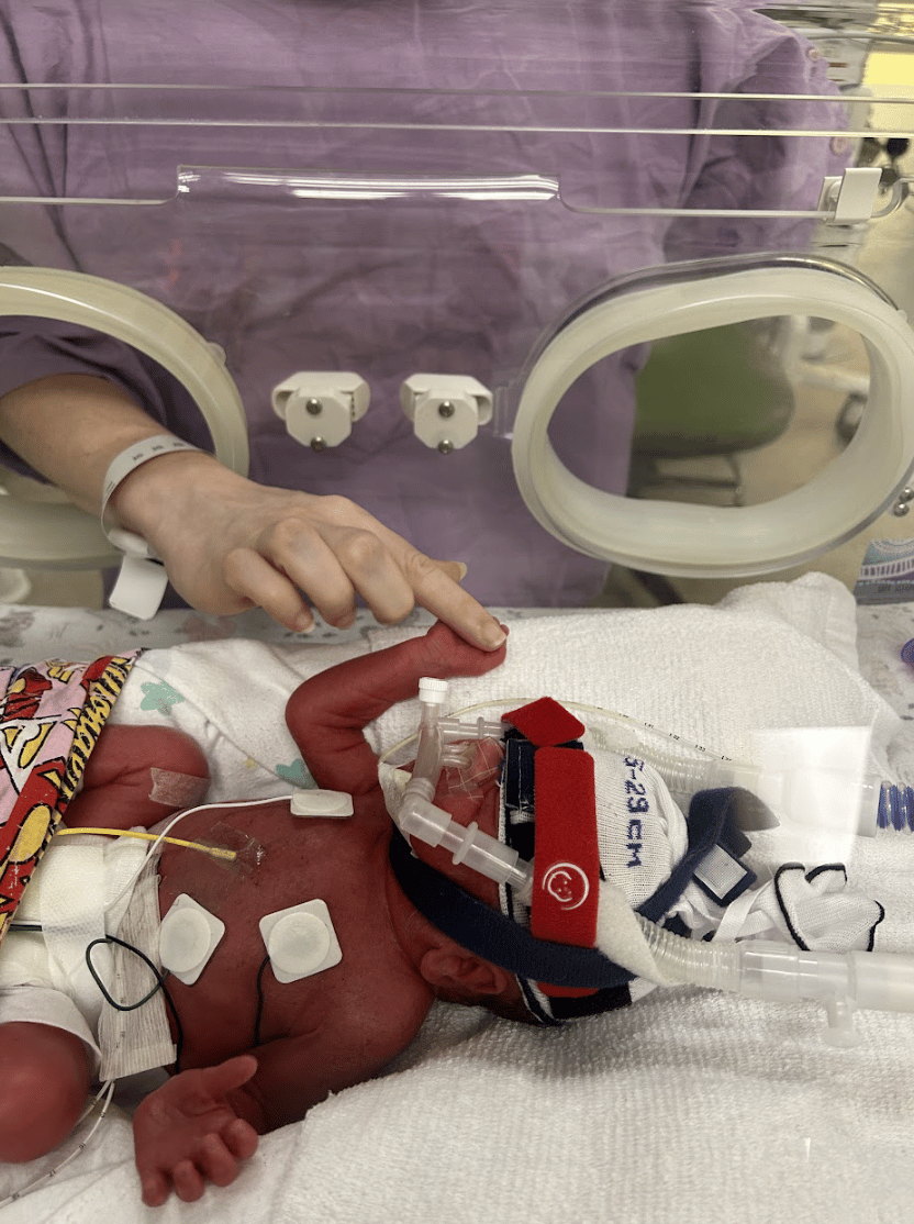 A baby with red tinged skin holds its mother's finger while in the NICU.