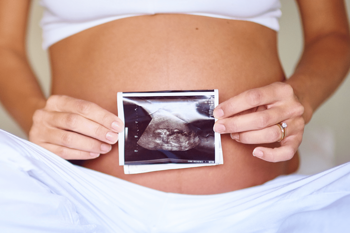 A photo of a soon-to-be mother holding her ultrasound. 