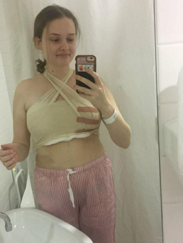 Natalie during the breast reduction surgery.