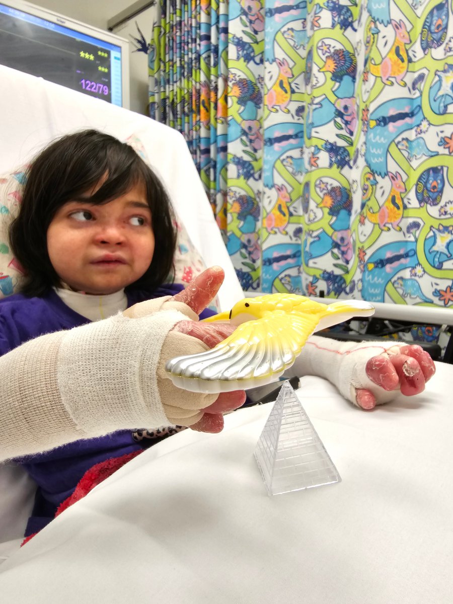 Siddiqah holding a plastic bird toy in hospital with recessive dystrophic epidermolysis bullosa.