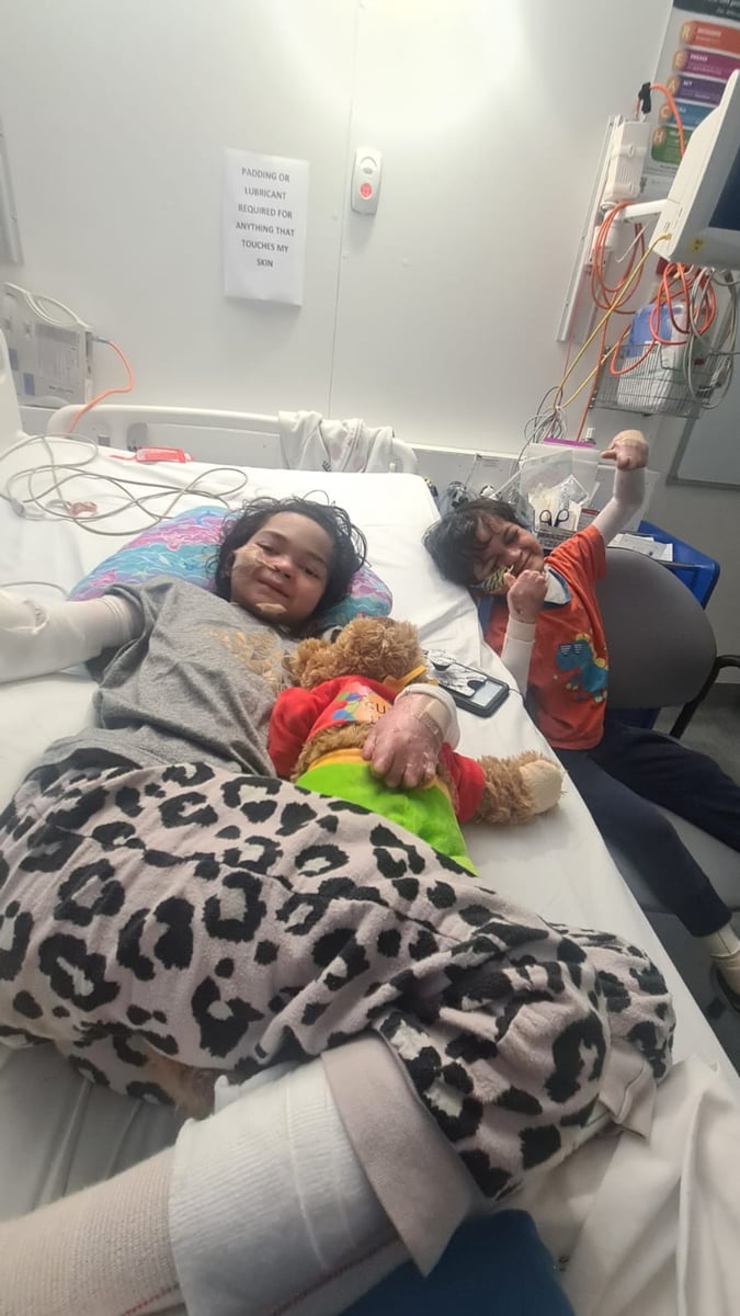 Kida Azny's children Siddiqah and Azraqee in hospital with epidermolysis bullosa.