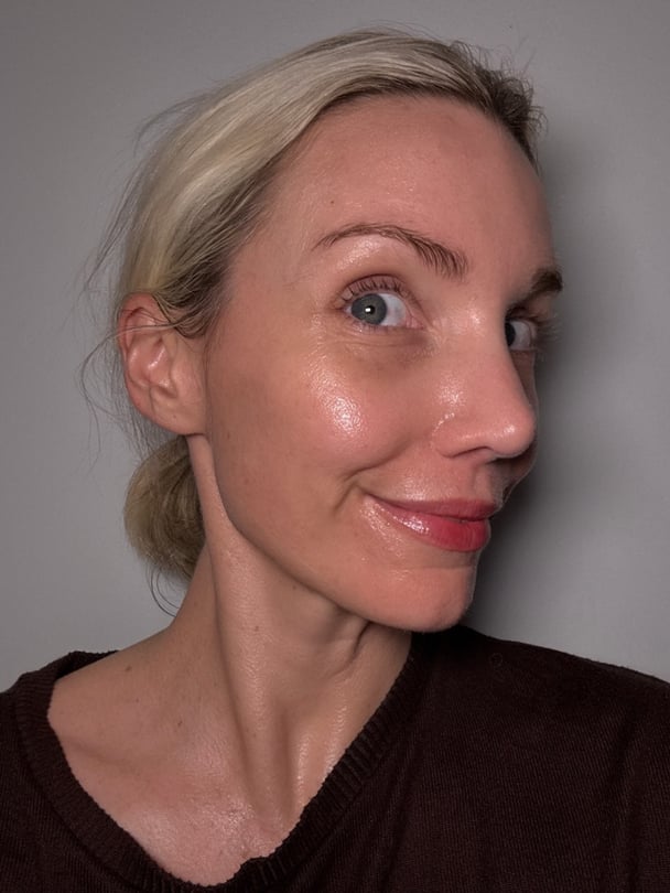 Skin after using Medik8 Exo-PDRN Prismatic+ Serum.