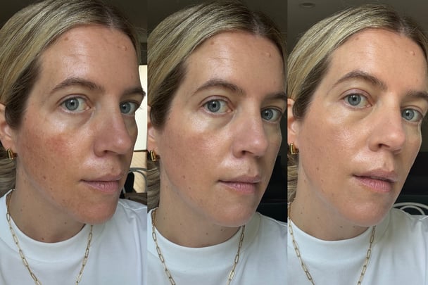 before and after woman with no make up and foundation