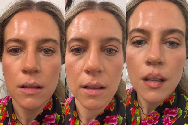 before, during and after of a woman using invisible eyelid tape on hooded eyes.