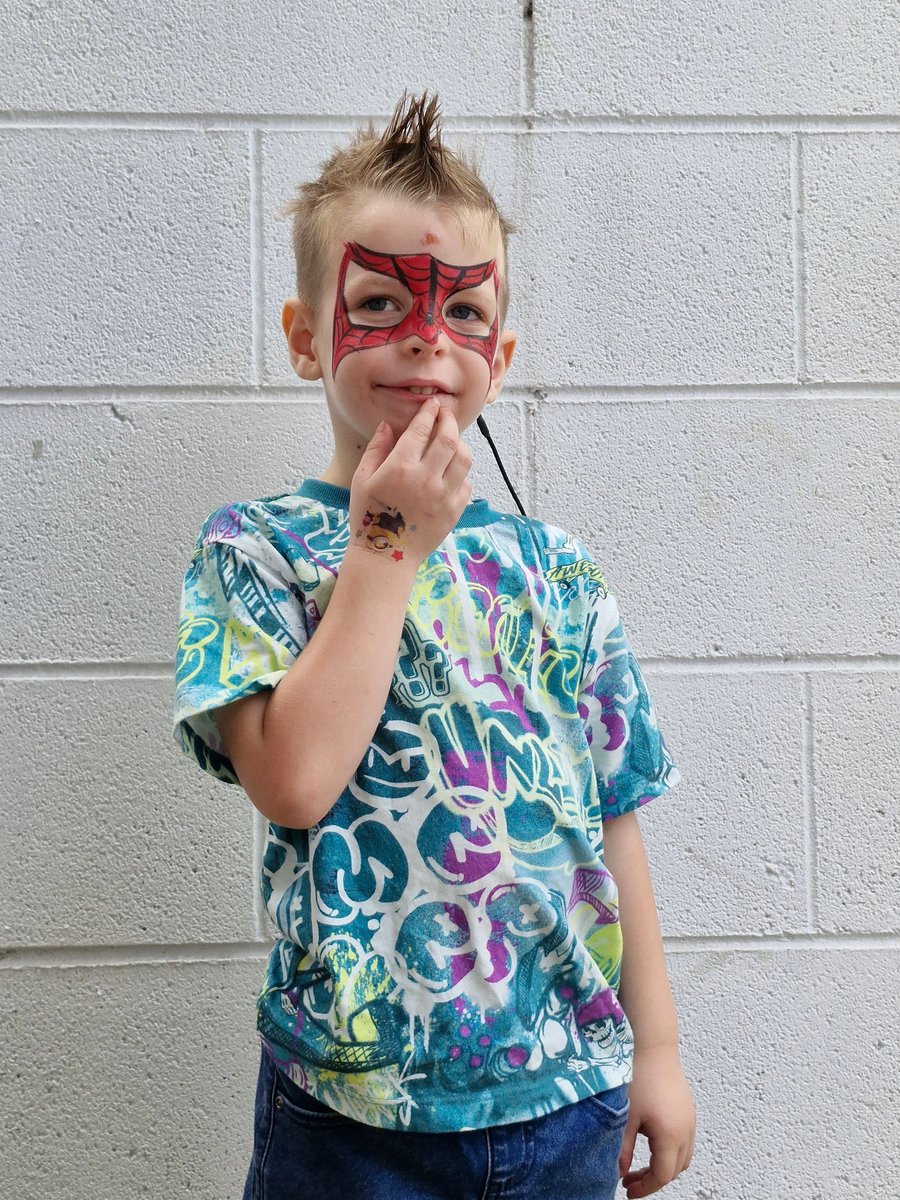 Leo has cerebral palsy caused by congenital CMV.