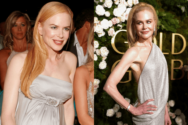 Gold or silver jewellery: How to figure out which one suits you.