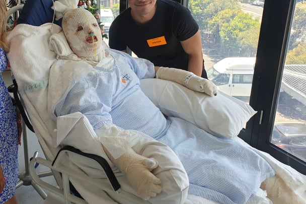Stephanie Browitt at the hospital in New Zealand after surviving the 2019 White Island eruption, recovering from her injuries.