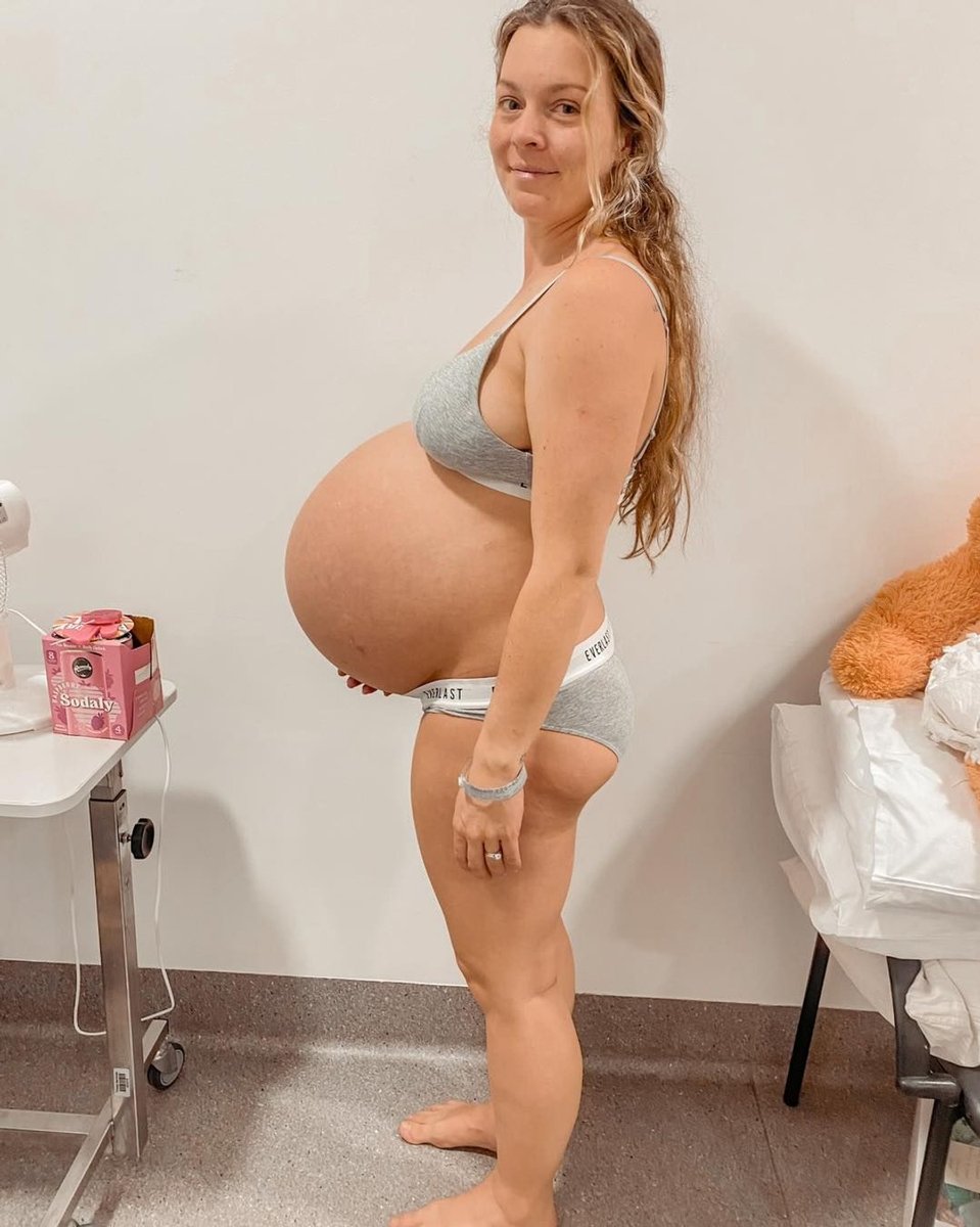 Taylah Tudehope Glachan pregnant with quadruplets. 