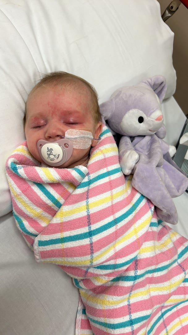 A baby swaddled in hospital with a feeding tube.